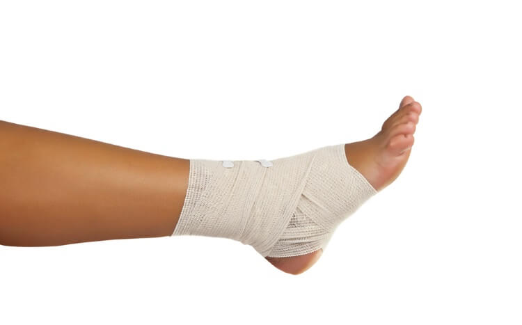 How to Care for a Sprain