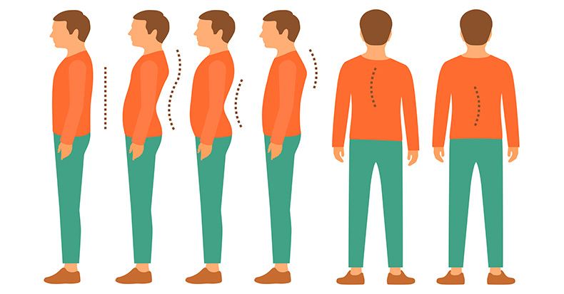 Exercises for Improving Cervical Posture