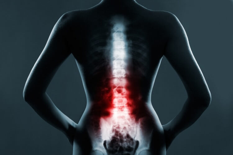 Does Posture Really Influence Pain?