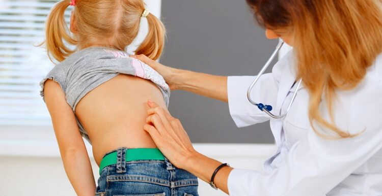 How to Treat Your Child’s Mild Scoliosis